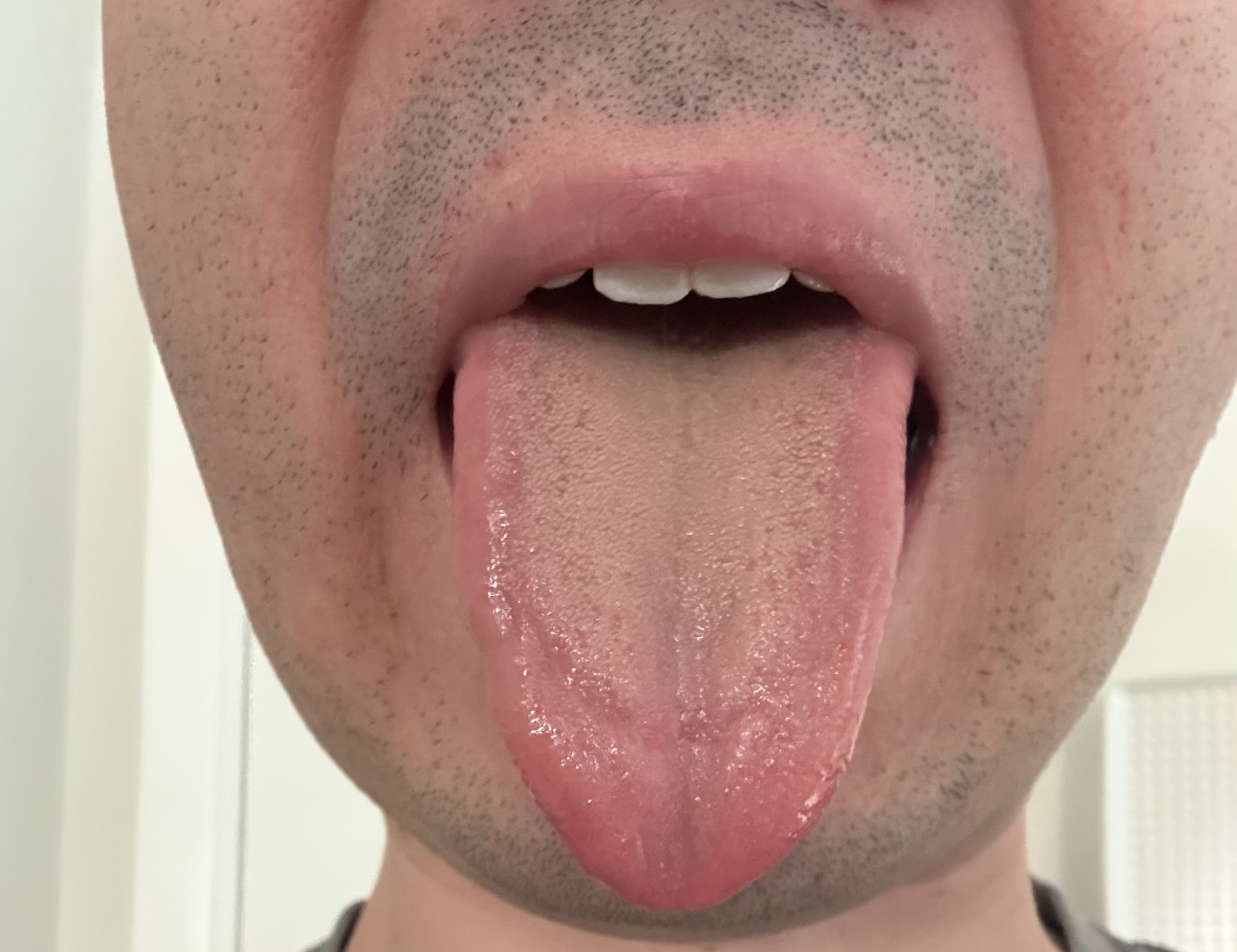 Example tongue photo